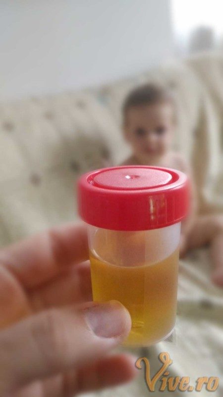 Fetita mea de 14 luni are infectie urinara